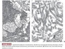 (b,c) tnts connecting primary malignant cells . Pleura Basicmedical Key