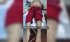 صور قصة م رعبة أم تقيم حفل تعذيب لطفلها بمساعدة ابنتها وخطيبها مبتدا