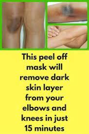 Pin On Beauty Skin