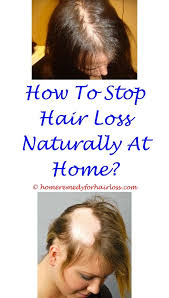 Pin On Children With Hair Loss