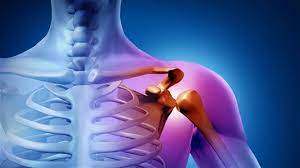 kol uyusmasi ve omuz agrisi hangi bolume gidilir