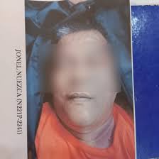 Bureau of Corrections released photos confirming the death of Jonel Nuezca  the suspect in the murder of Sonia and Frank Gregorio.