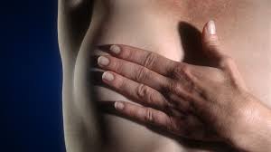 6j apres l operation,reconstruction du sein droite apres mastectomie et implant aussi dans le gauche pour une symetrie Cancer Du Sein Et Reconstruction Mammaire Oiiq