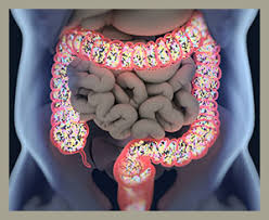 Food Protein Induced Enterocolitis Syndrome Fpies And