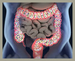 food protein induced enterocolitis syndrome fpies and