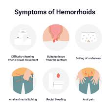 Image result for Hemorrhoid