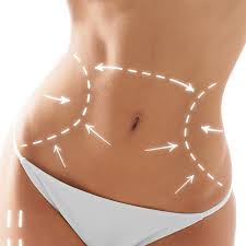La liposuccion douce est une avancée majeure dans le traitement des graisses de la silhouette et de la cellulite. Abdominoplastie A Bordeaux Chirurgie Du Ventre A Clinique Esthetique