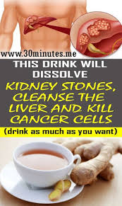 Pin On Natural Home Remedies