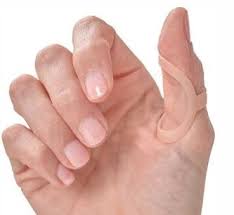 This is a great trick once you learn it. Trigger Thumb Causes Symptoms And Treatment Oh My Arthritis