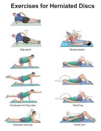 The hamstrings are depicted above in red. Exercises For Herniated Disc