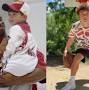 Profile Picture of Born with a rare bone disease, 