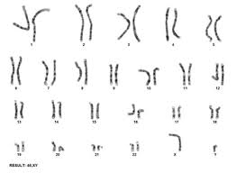 Chromosome Analysis Karyotyping Lab Tests Online Au