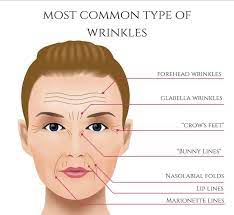 Wrinkles How To Line Lips Wrinkles Forehead Wrinkles