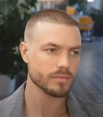 Do all hairtransplants look fake when buzzed? This guy is 2 years post op  and the transplant is obvious : r/HairTransplants