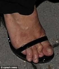 Yesterday on late night with jimmy fallon, the actress chatted about the big controversy and wardrobe malfunction that made her pinky toes shine in the limelight after they got. Kim Kardashian S Swollen Feet And Julianne Moore S Crippled Toes The Worst Celebrity Foot Faux Pas Daily Mail Online