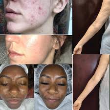 Triangle Acupuncture Clinic