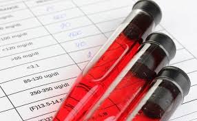 Αναζητηση check up αναζητηση αλλεργιογονων αναζητηση στη διαγνωστική αθηνών απαντάμε σε κάθε σας απορία σχετικά με τις εξετάσεις που κάνετε στο. Oi Fysiologikes Times Sidhroy Kai O Ti Prepei Na Gnwrizete Gia Thn Anaimia Onmed Gr