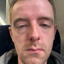 This happens only in Australia. Kangaroo waiting for his dinner at farm  house.