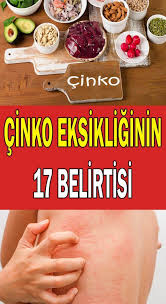 Vucudunuzda Cinko Eksikligi Oldugunu Gosteren 17 Belirti Sosyolife Net Saglik Ipuclari Saglik Saglikli