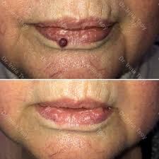 Красные родинки: причины появления красных точек на теле и грудях — MLC