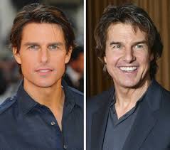 What Happened to His Face?” Mission Impossible Star Tom Cruise's Shocking  Before & After