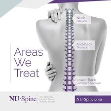 People who live in these areas or have worked in them in the. Procedures Treatments Nu Spine