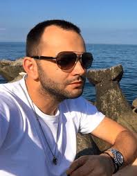 Mihai Morar şi-a făcut implant de păr