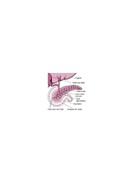 Relato oficial del 61º congreso uruguayo de cirugía 5. Acute Pancreatitis Symptoms Treatment Causes Disturbios Digestivos Manual Msd Versao Saude Para A Familia