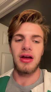 How to Clean Bleach Stain from Wood Countertop