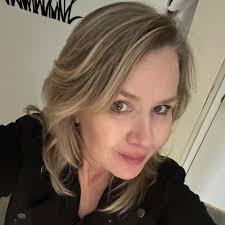 A few months ago, I posted the tragic story of my man Greg. He was  unfortunately the victim of a brutal dog attack where his #eyelid was  partially amputated. Well, Greg is