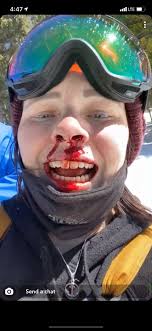 Fundraiser for Ashlyn Porter by Luke Noble : Ashlyn's medical bills