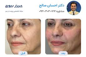 10 بهترین دکتر جوانسازی پوست در شیراز + 7 درمان جوان سازی