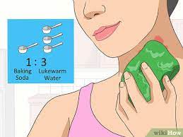 3 Ways To Treat A Rash On The Neck Wikihow