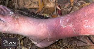 Image result for Pigment stains on the shin