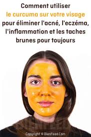 Comment Utiliser Le Curcuma Sur Votre Visage Pour Eliminer L Acne L Eczema L Inflammation Et Les Taches Brunes Pour Toujours Creme Cake Decorating Tips Eczema