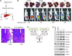 For incorrect answers, click on 'description' to review information about the processes. Jci Apobec3g Promotes Liver Metastasis In An Orthotopic Mouse Model Of Colorectal Cancer And Predicts Human Hepatic Metastasis