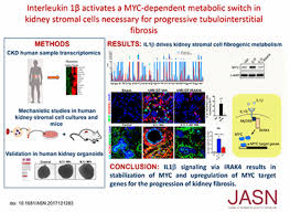 Maybe you would like to learn more about one of these? Interleukin 1b Activates A Myc Dependent Metabolic Switch In Kidney Stromal Cells Necessary For Progressive Tubulointerstitial Fibrosis American Society Of Nephrology