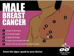 Male breast cancer is staged (reflecting the extent of tumor spread) identically to breast cancer in women. Bwgovernment Male Breast Cancer A Lump In The Breast Facebook