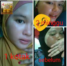 Beza dgn produk di luar sebab ianya bebas paraben atau kimia merbahaya. Bee Venom Legasi Domas Bee Venom Skincare 4in1