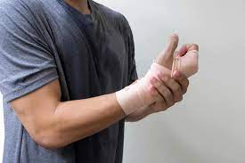 Elevate your arm above your heart. 7 Recovery Tips For Broken Wrist Injuries Orthobethesda