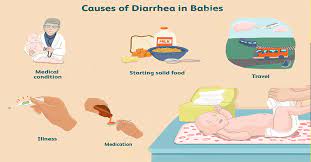 However, the body also throws out fluid, electrolytes, and nutrients. Diarrhea In Babies Causes Symptoms And Treatment