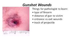 Measure the length, diameter or . Autopsy Forensic Pathology Ppt Video Online Download