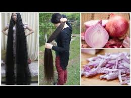 Soganla Hizli Sac Uzatma Ve Kalinlastirma Super Hizli Sac Uzatma Yontemi Izledigin Icin Tesekkurler Sende Aramiza Katilmak Sac Uzatma Sac Hizli Sac Uzama