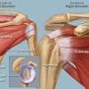 Muscles of the shoulder can be divided into two strata: 1