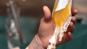 Image result for Plasma Transfusion