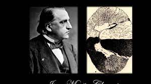 Charcot foot is a condition causing weakening of the bones in the foot that can occur in people who have significant . Jean Martin Charcot 1825 1893 Youtube
