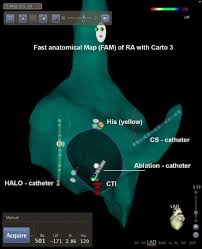 Unde pot vedea episodul 524 din la bloc (ultimul)? Special Program And Abstract Issue Of The 6th Congress Of The European Cardiac Arrhythmia Society Springerlink