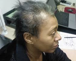 As early as i can remember i was doing hair, i think i fell out the womb with a comb and scissors. Hairstyles For Medium Damaged Hair Kuora X