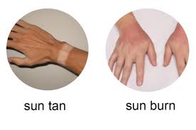 She and may ho are both malaysian bloggers. Betul Ke Ramai Tidak Tahu Kepentingan Pakai Sunblock Sunscreen Untuk Elak Kanser Kulit Daily Rakyat