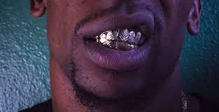 1 on billboard 200 albums chart. The History Of Putting Grills Diamonds On Teeth Toothology Dental